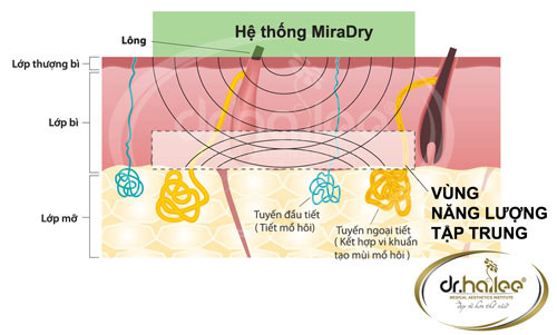 Bí quyết “chữa cháy” chứng hôi nách - 4