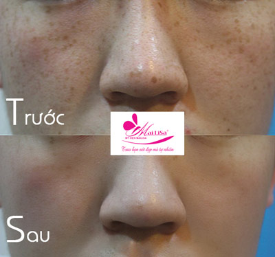 Bí quyết ngày một trẻ đẹp của Mạc Anh Thư - 6