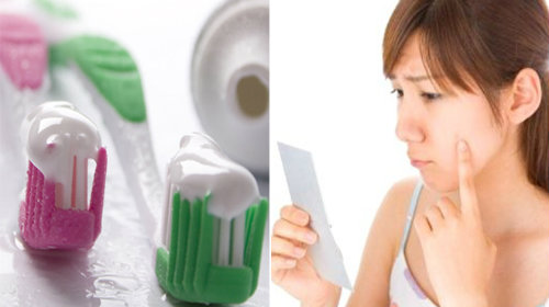 Loại bỏ mụn cấp tốc cho bạn gái đi chơi ngày 20/10 - 4