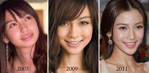 Angelababy được chứng nhận chưa từng phẫu thuật thẩm mỹ - 9