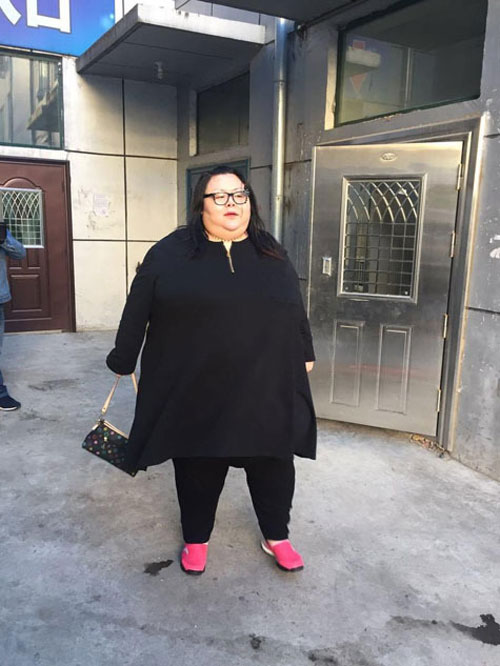 Trung Quốc: Cô gái phải cắt dạ dày để giảm cân - 3