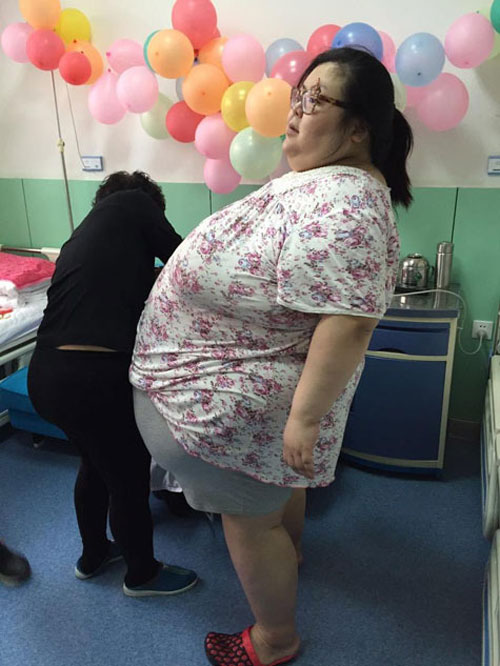 Trung Quốc: Cô gái phải cắt dạ dày để giảm cân - 5