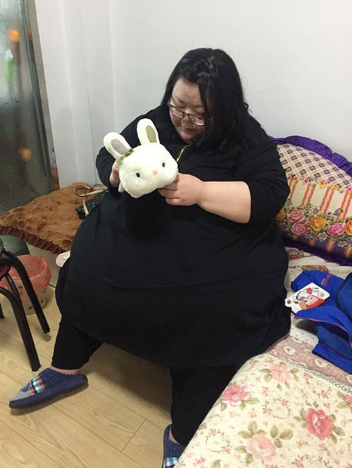 Trung Quốc: Cô gái phải cắt dạ dày để giảm cân