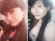 Làm đẹp - Nghe cô gái Việt kể chuyện phẫu thuật gọt mặt