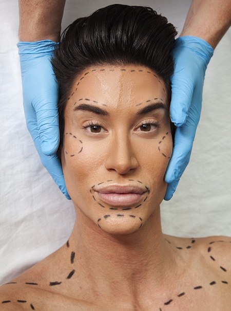 Justin Jedlica đã trải qua hơn 340 ca phẫu thuật