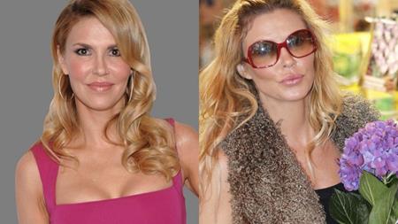 Nữ diễn viên Brandi Glanville dường như cũng đã tìm đến dao kéo để nâng xương cằm và “tân trang” cho bờ môi.