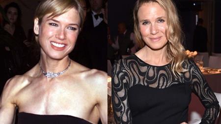 Vẻ bề ngoài của “tiểu thư Jones” Renee Zellweger vẫn luôn là chủ đề bàn tán sôi nổi tại Hollywood. Chỉ sau vài năm, nét bầu bĩnh, đáng yêu trên gương mặt Renee đã hoàn toàn biến mất, thay vào đó là một nét mặt cứng đờ và thiếu tự nhiên.